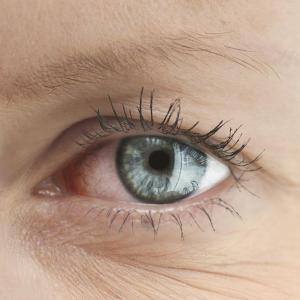 Investigational drug for dry eye disease scores high in phase III study