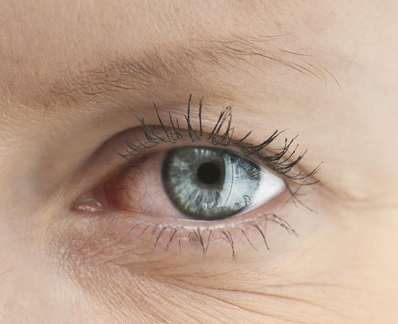 Investigational drug for dry eye disease scores high in phase III study