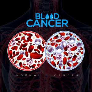 Aspergillosis and Mucormycosis