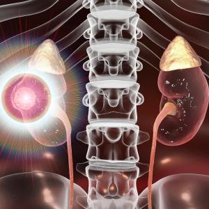 Atezolizumab proven safe, effective in understudied urinary tract carcinoma patients