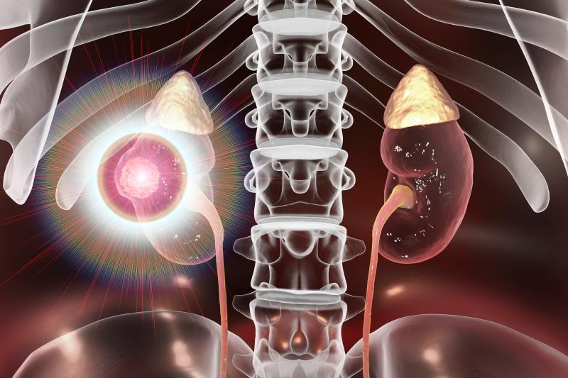 Atezolizumab proven safe, effective in understudied urinary tract carcinoma patients