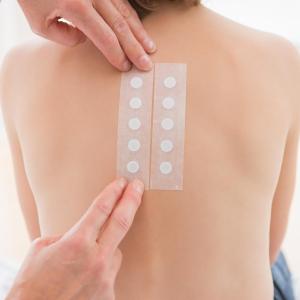 Patch test a boon to dupilumab-treated patients