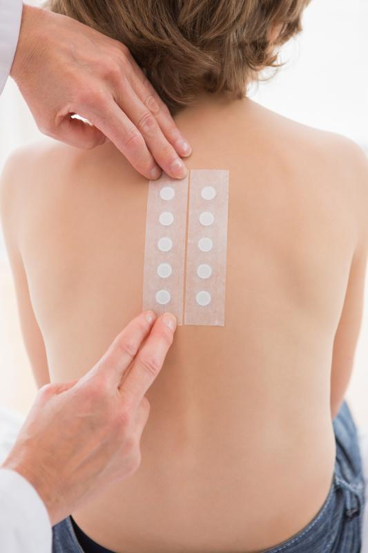 A prospective, multicentre study has demonstrated the efficacy of patch tests (PTs) for patients who are being treated with d