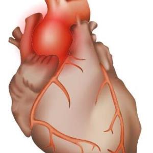 Aortic Aneurysm: โรคหลอดเลือดแดงใหญ่โป่งพอง