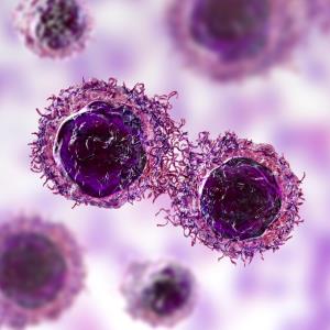 CAR T-cell therapy trumps standard care in earlier-line lymphoma