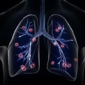 AZD7442 cocktail protects against symptomatic COVID-19 illness