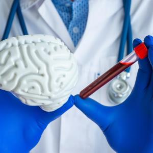 Blood test delivers precision to AD diagnosis in primary, secondary care