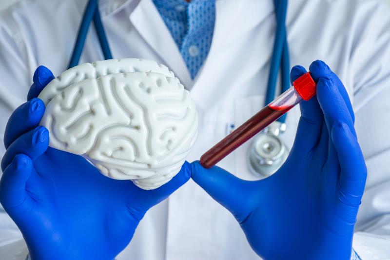 Blood test delivers precision to AD diagnosis in primary, secondary care