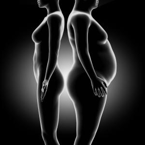Weight loss surgery delivers lasting quality-of-life benefits for people with T2D, obesity