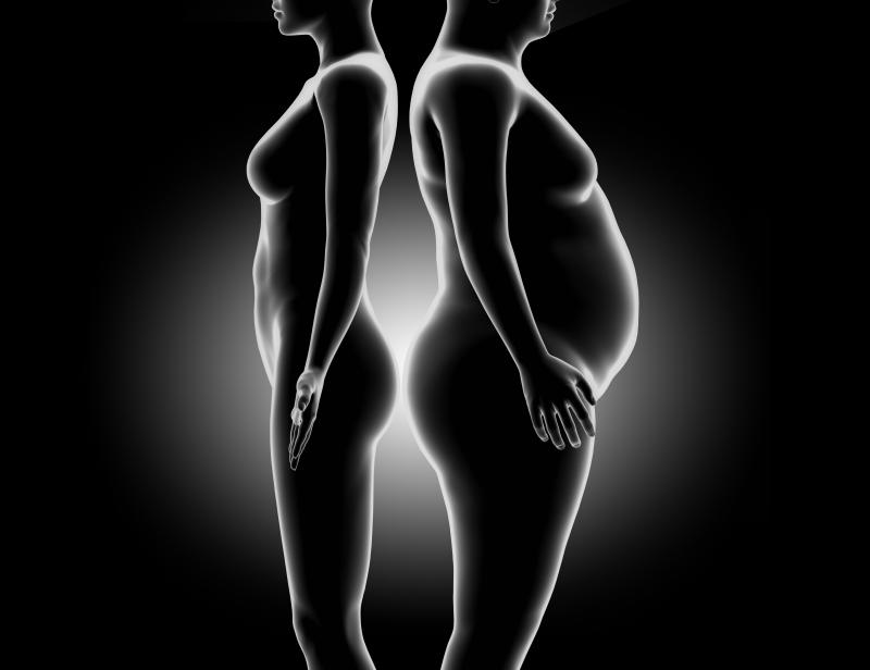 Weight loss surgery delivers lasting quality-of-life benefits for people with T2D, obesity