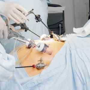 Bariatric surgery ups risk of birth defects in subsequent pregnancies