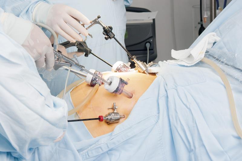 Bariatric surgery reduces risk of all-cause death