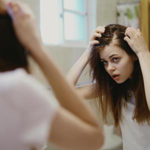 Ritlecitinib, brepocitinib show promise against scalp alopecia areata