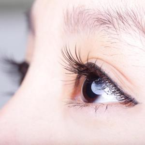 Does xanthelasma palpebrarum elevate dyslipedemia, CVD risk?