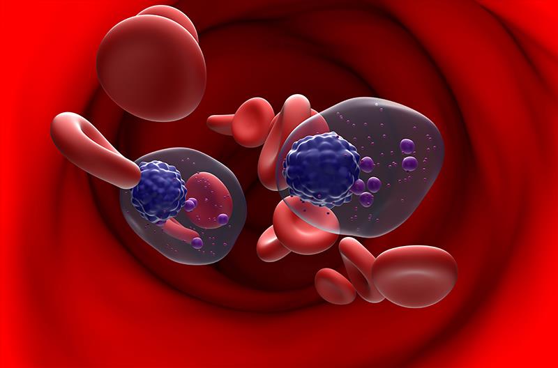 Belamaf plus pomalidomide/dexamethasone improves PFS in relapsed/refractory multiple myeloma