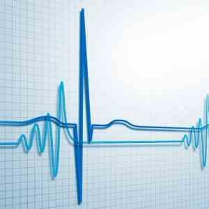 Timing of VT ablation does not factor in outcomes of patients with ICDs