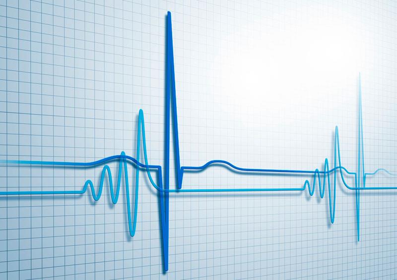 Timing of VT ablation does not factor in outcomes of patients with ICDs