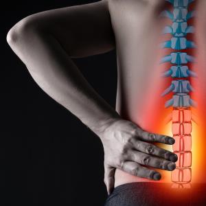 Bimekizumab shows promise across the spectrum of axial spondyloarthritis