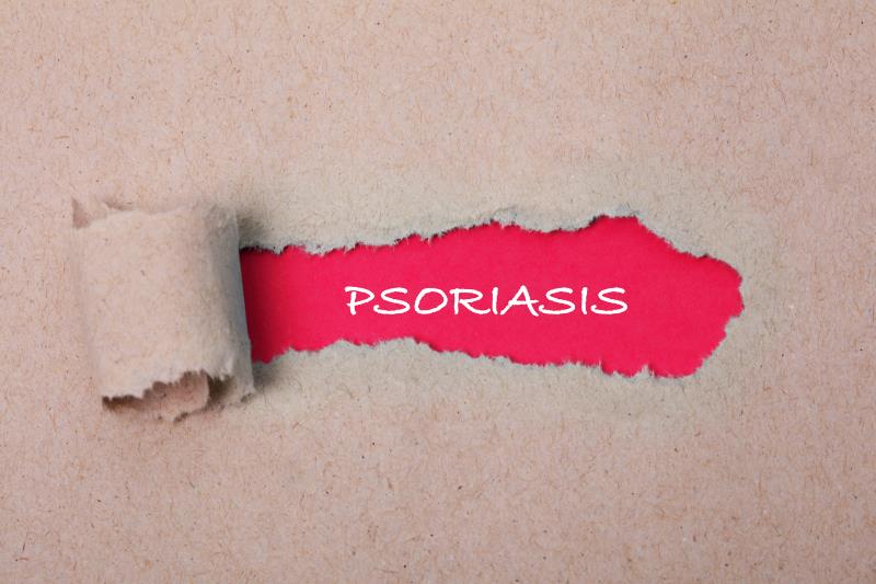 Anti–IL-23 monoclonal antibody shows promise in plaque psoriasis