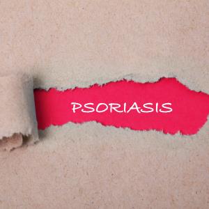 Psoriasis cream scores high in DERMIS trials