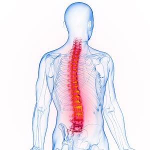 Radiographic progression minimal even after long-term bimekizumab use in r-axSpA patients