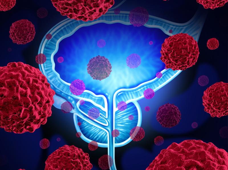 Atezolizumab may prolong survival in bladder cancer