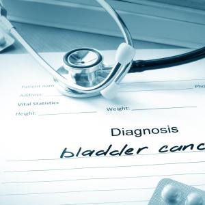 Finasteride lowers bladder cancer risk in men, but not in Blacks