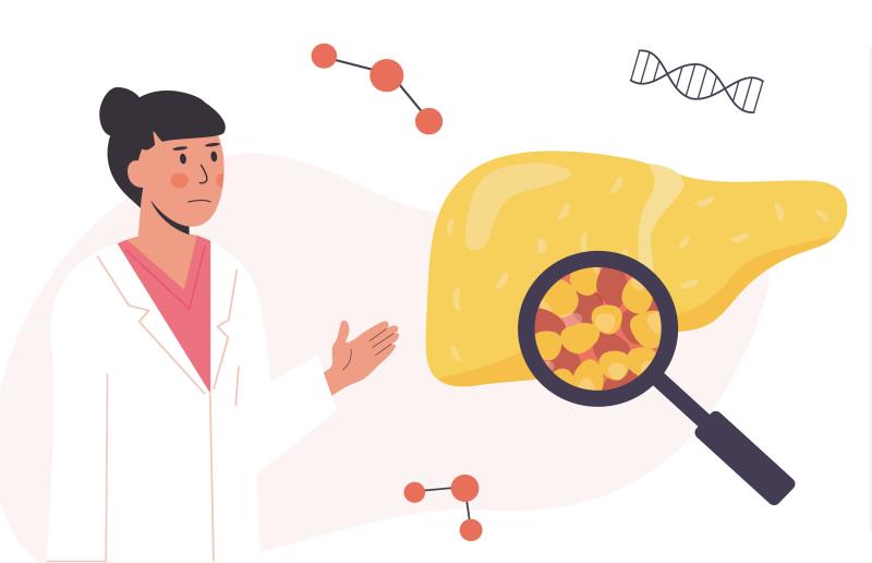 Blood-based biomarker panel aids noninvasive diagnosis of MASH