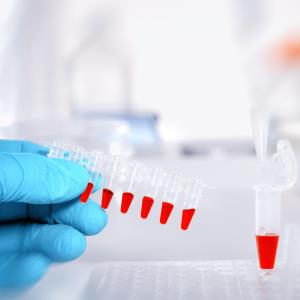 Blood biomarkers: Harbingers of heart failure, respiratory tract infections in stroke