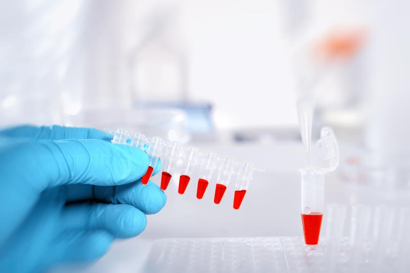 Blood biomarkers: Harbingers of heart failure, respiratory tract infections in stroke