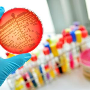 ESRD, treatment resistance tied to persistent bacteraemia