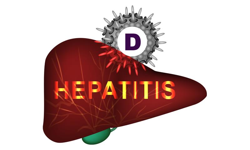Bulevirtide monotherapy sustains virologic, biochemical responses in CHD