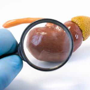 Diabetes, obesity tied to upstaging in renal cell carcinoma