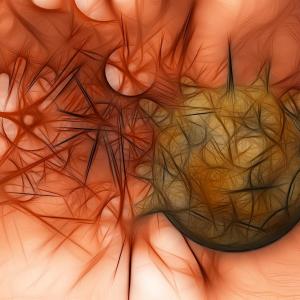 Cell-cycle progression tied to metastasis-free survival in high-risk prostate cancer