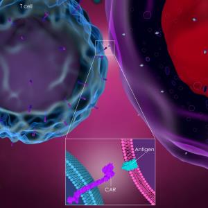 CAR T-cell therapy for relapsed/refractory diffuse large B-cell lymphoma