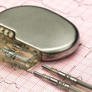 Remote sensing helpful for noise detection in pacemaker leads