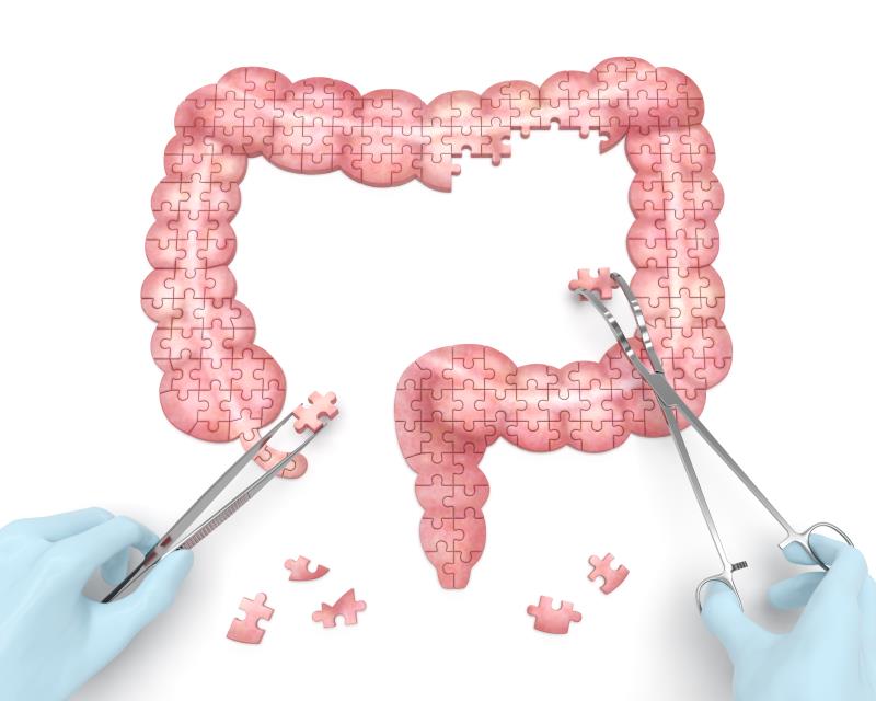 Studies support vedolizumab benefit for IBD