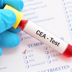 CEA may predict better survival with targeted therapy in mCRC