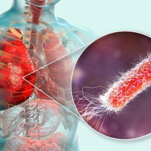 Etomidate use for RSI not linked to nosocomial infection