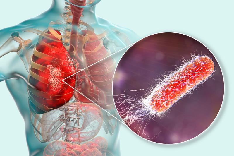 Etomidate use for RSI not linked to nosocomial infection