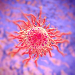 Malnutrition tied to poor survival in metastatic cervical cancer