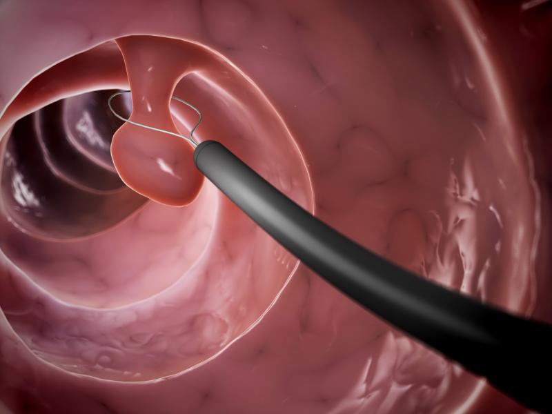 Endoscopic submucosal dissection safer, more cost-effective than transanal endoscopic microsurgery