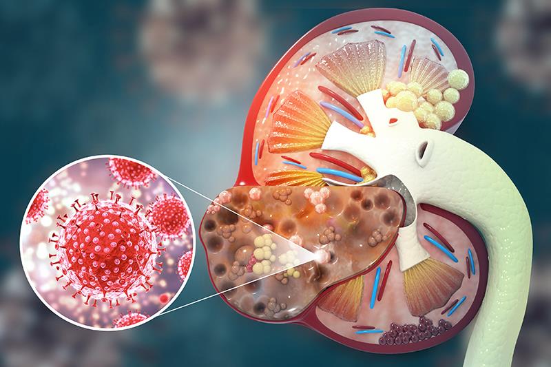 Nivolumab + cabozantinib combo maintains survival benefit, response in advanced RCC