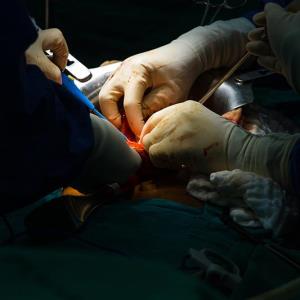 Chemo plus liver transplant prolongs survival in unresectable colorectal liver metastases