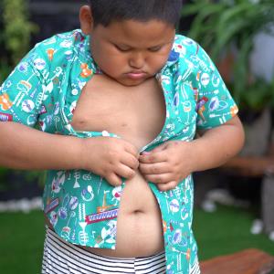 Childhood obesity ups risk of essential hypertension