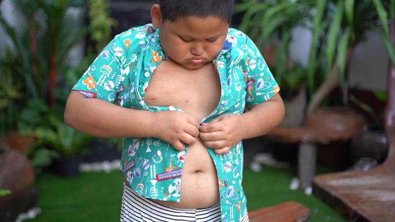 Childhood obesity ups risk of essential hypertension