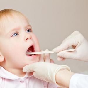 Upper respiratory symptoms more common in children with pharyngitis identified as GAS carriers