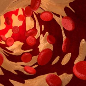 High cholesterol tied to better survival among older adults