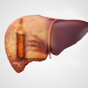 Subgroup analysis CONFIRMs telipressin potential for treating HRS, alcoholic hepatitis