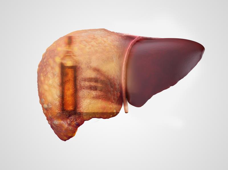 Subgroup analysis CONFIRMs telipressin potential for treating HRS, alcoholic hepatitis